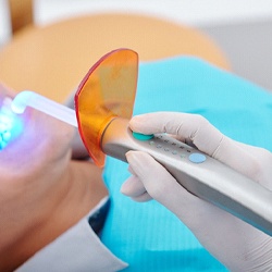 A dentist using a specialized curing light to harden the resin onto a patient’s tooth