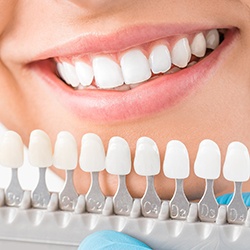 Teeth compared with color shading chart