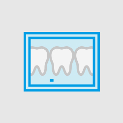 Animation of dental x-rays