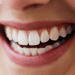 Homer Glen Dentures & Partials | Restorative Dentist | DeAngelo Dental
