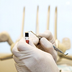 A dentist removing a small portion of composite resin in preparation of applying it to a patient’s tooth