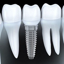Implant supported dental crown