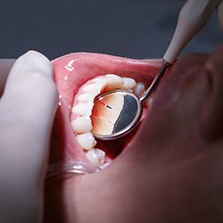 Closeup of healthy teeth and gums