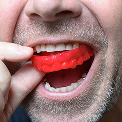 Man removing red mouthguard from teeth