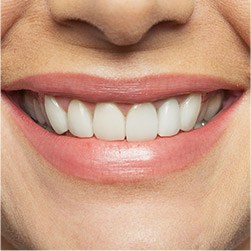 Closeup of flawless healthy smile