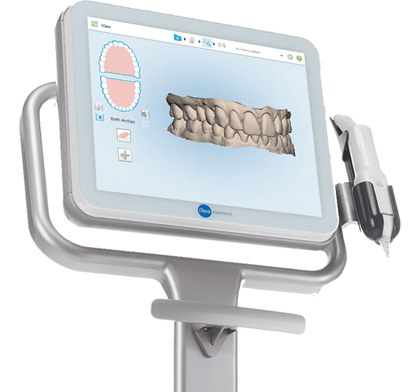 Digital scans of teeth on dental computer