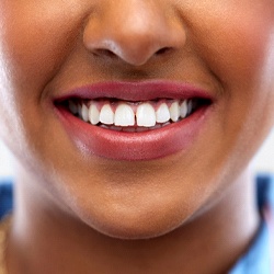 A woman with a gap between her two front teeth