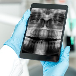 Dental x-rays on tablet computer