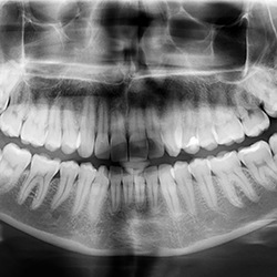 Digital x-rays on computer