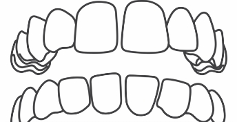 Gap teeth image