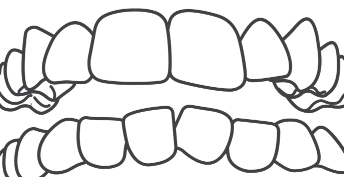 Crooked Teeth image
