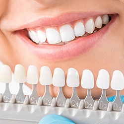 Zoom whitening shade guide - fadcasting