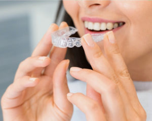 Woman inserting clear aligner