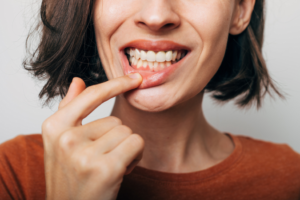 a person smiling and pointing to their gums 